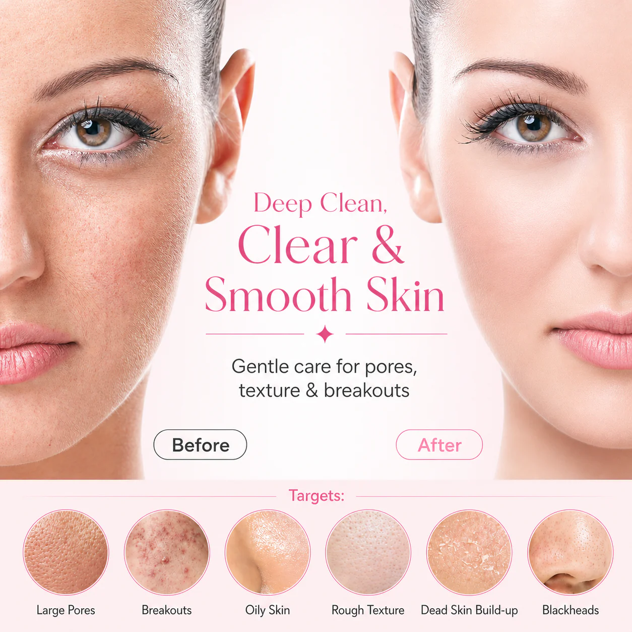 PerfectClense™ Skin Reset Cleansing System