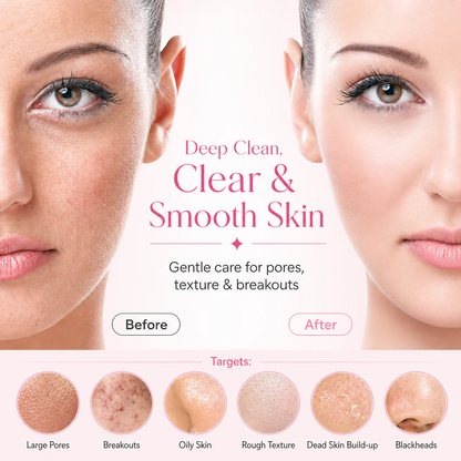 PerfectClense™ Skin Reset Cleansing System